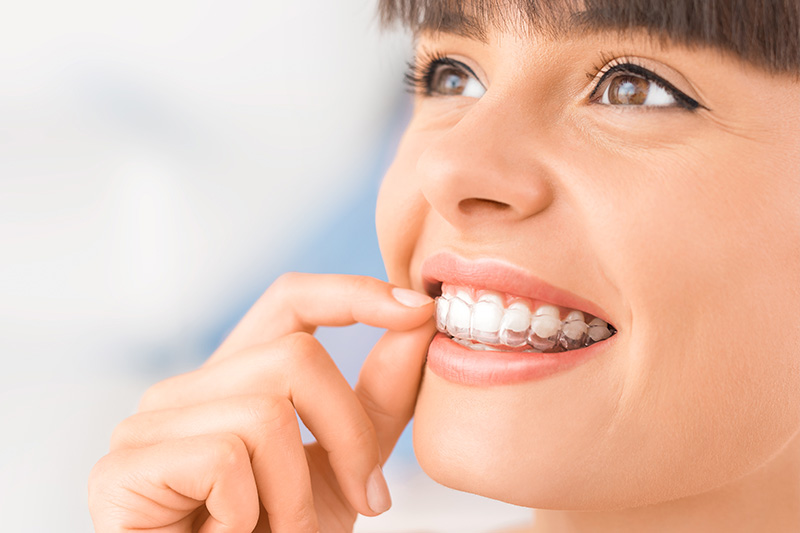 Invisalign in Irving